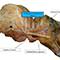 The Anterolateral Ligament